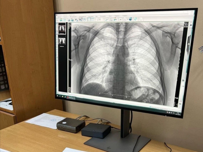 Жители отдалённых районов Читы смогут пройти бесплатное флюорографическое обследование