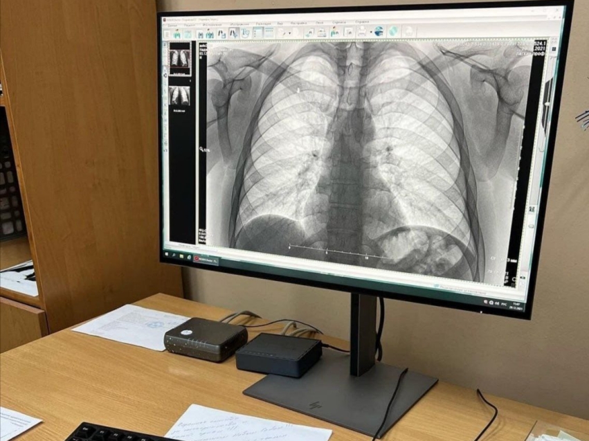 Более сотни жителей Забайкалья бесплатно проверили свои лёгкие