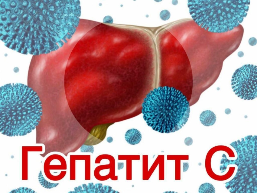 ВИРУСНЫЙ УБИЙЦА – ГЕПАТИТ С